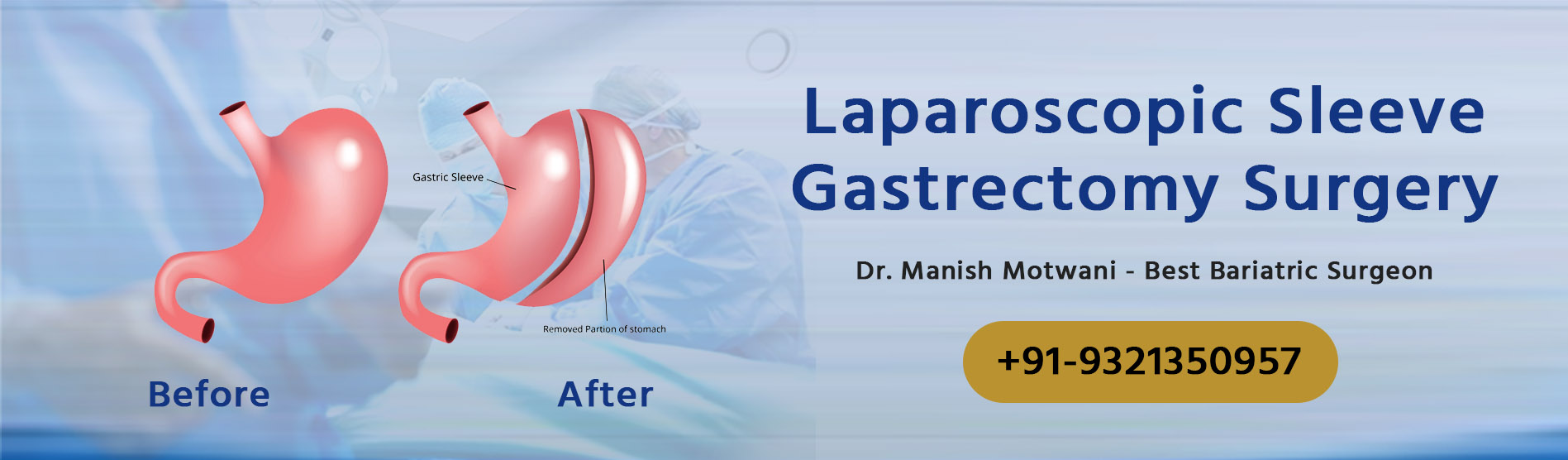 Laparoscopic Sleeve Gastrectomy Surgery (Mumbai) - Cost & Procedures