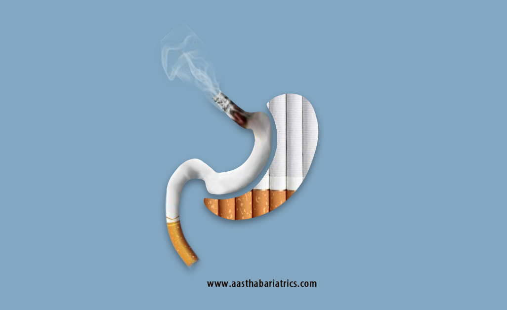 smoking after bariatric surgery