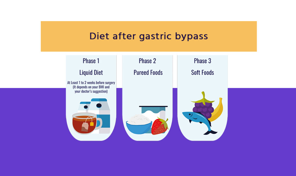 Diet After Gastric Bypass Surgery (Indian Diet) - Aastha Bariatrics