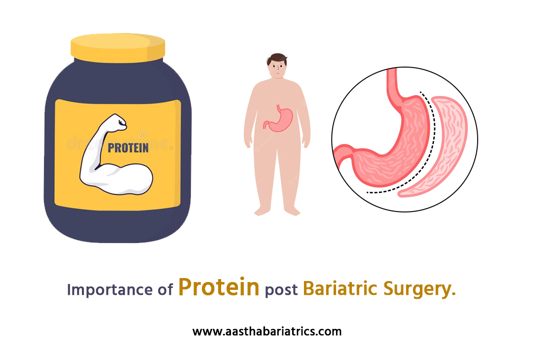 Post surgery protein requirements and benefits – Vida-Fuel