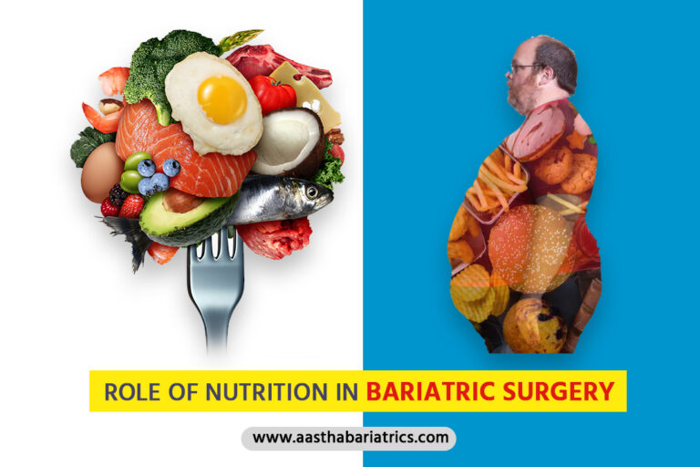 Role Of Nutrition In Bariatric Surgery - Aastha Bariatrics