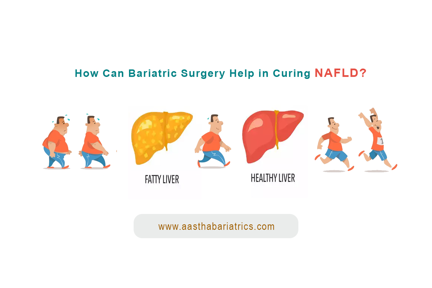 bariatric-surgery-improves-nonalcoholic-fatty-liver-disease-systematic