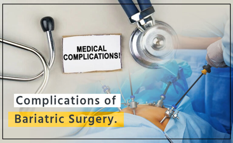 complications of bariatric surgery