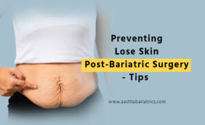 preventing lose skin post bariatric surgery tips