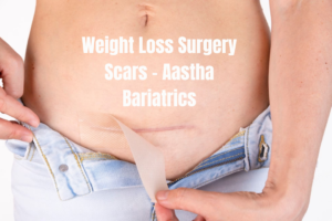 Weight Loss Surgery Scars