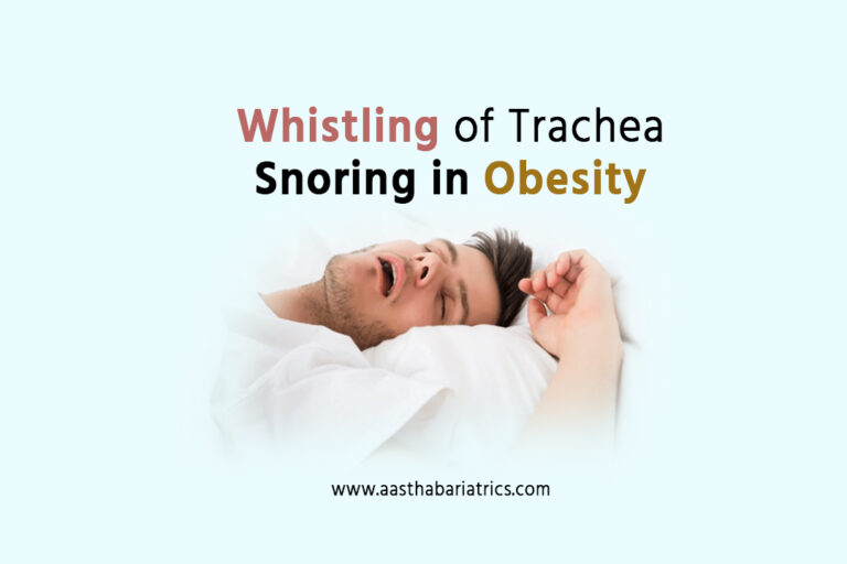 Whistling-of-Trachea-Snoring-in-Obesity