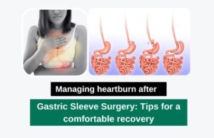 Gastric Sleeve Surgery - Tips for a comfortable recovery
