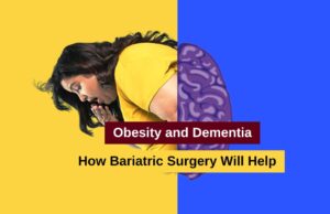 Obesity and Dementia How Bariatric Surgery Will Help