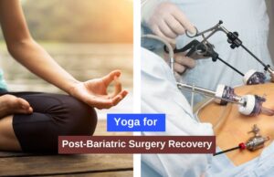 Yoga for Post-Bariatric Surgery Recovery