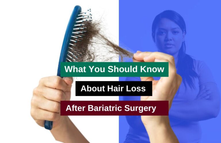 hair loss After Bariatric Surgery