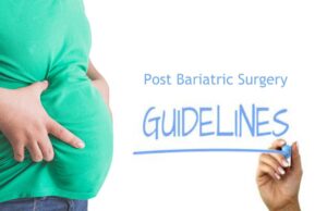 Guidelines Post-Bariatric Surgery