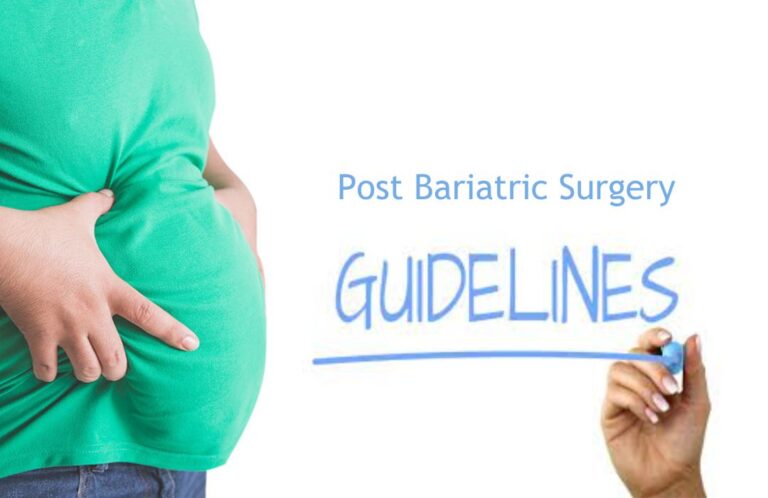 Dietary Guidance after Gastric Bypass or Sleeve Gastrectomy