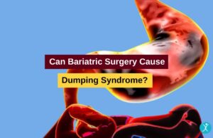 Bariatric Surgery and Dumping syndrome