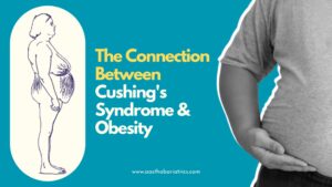 Cushings-Syndrome-and-Obesity