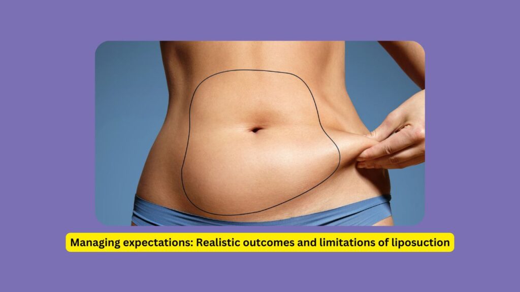 Managing-expectations-Realistic-outcomes-and-limitations-of-liposuction