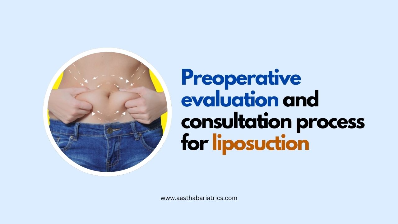 Preoperative evaluation and consultation process for liposuction