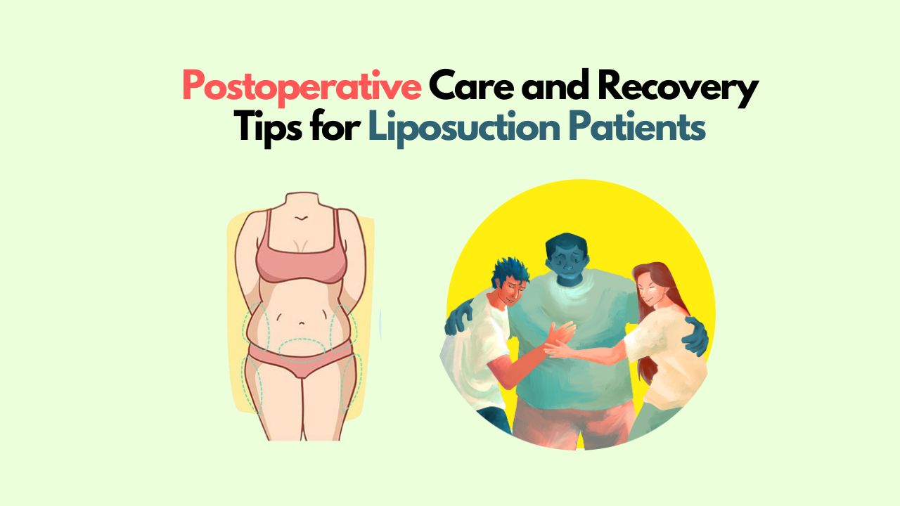 Recovery Tips for Liposuction Patients