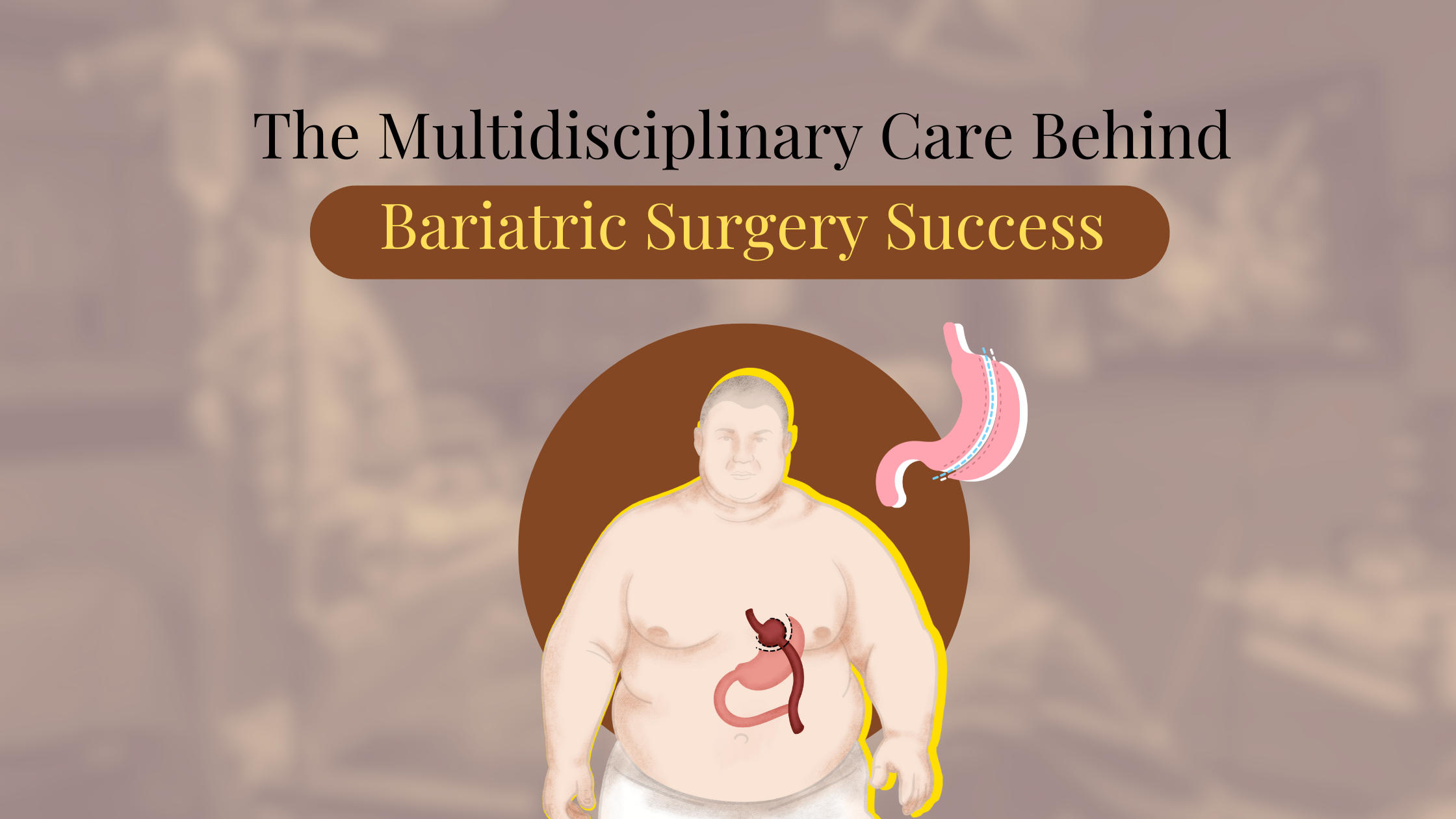 bariatric surgery blog