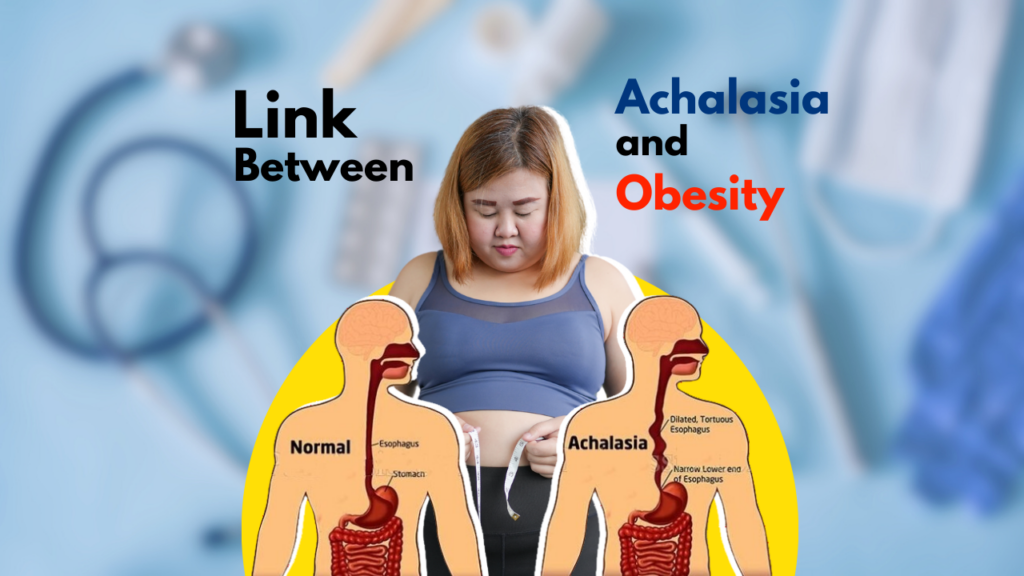 Link Between Achalasia and Obesity