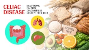Celiac Disease Explained