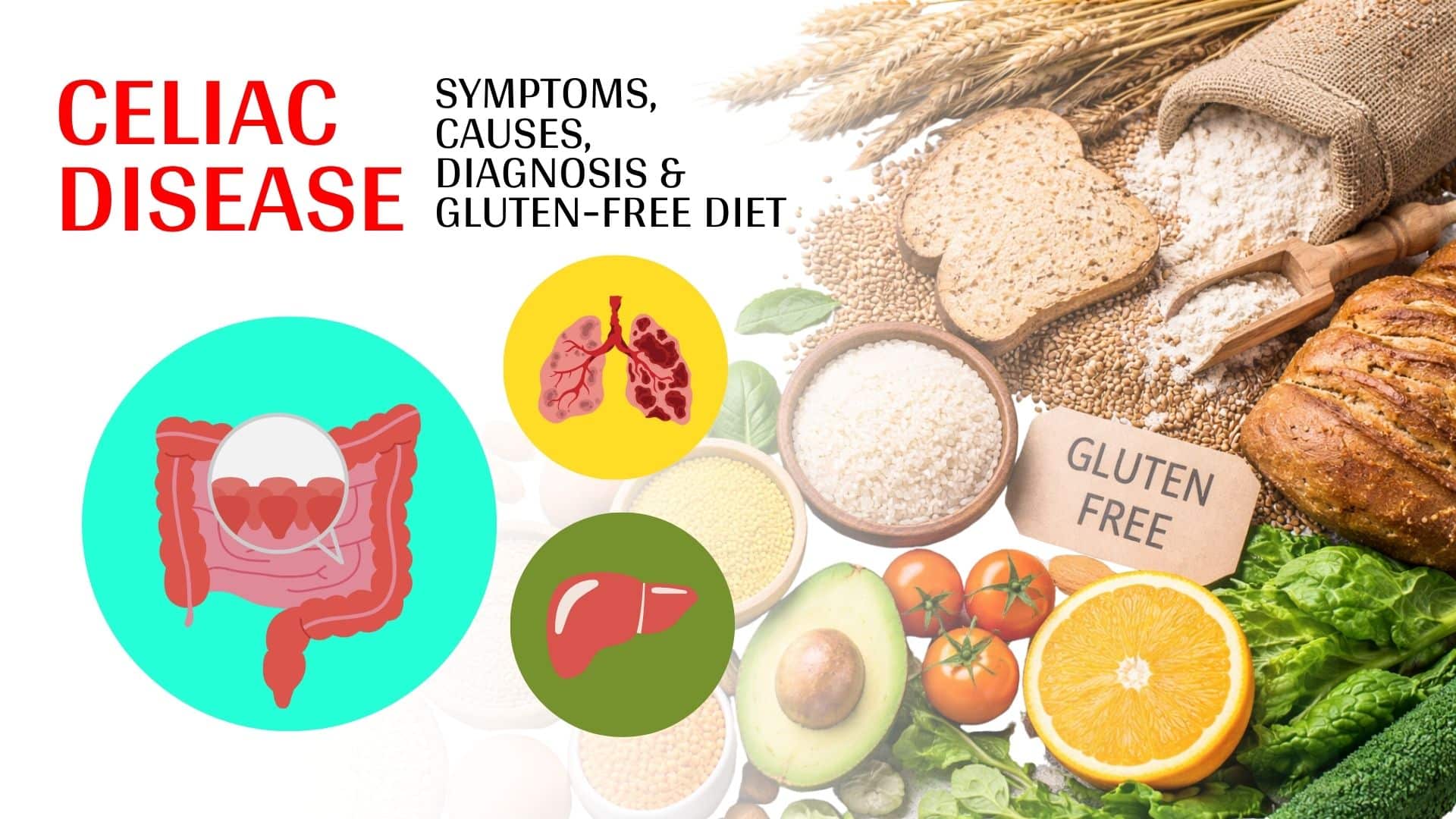 Celiac Disease Explained
