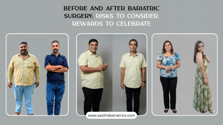 before and after bariatric weight loss surgery