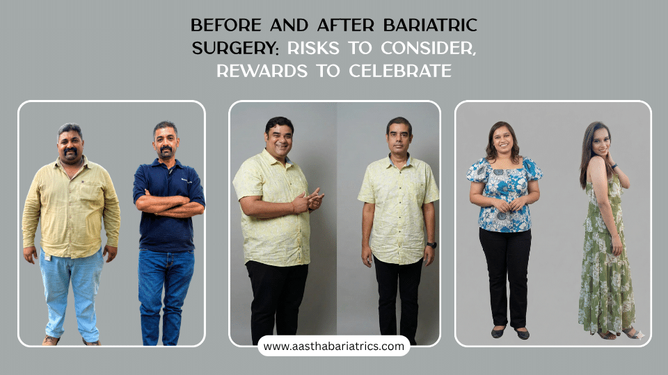 before and after bariatric weight loss surgery
